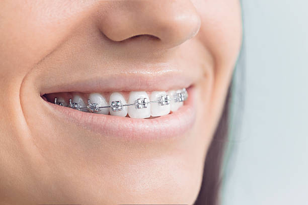 Best Dental Inlays and Onlays  in Porterville, CA